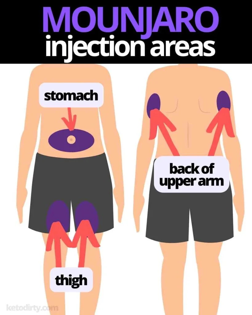 mounjaro injection areas stomach thigh back of arm