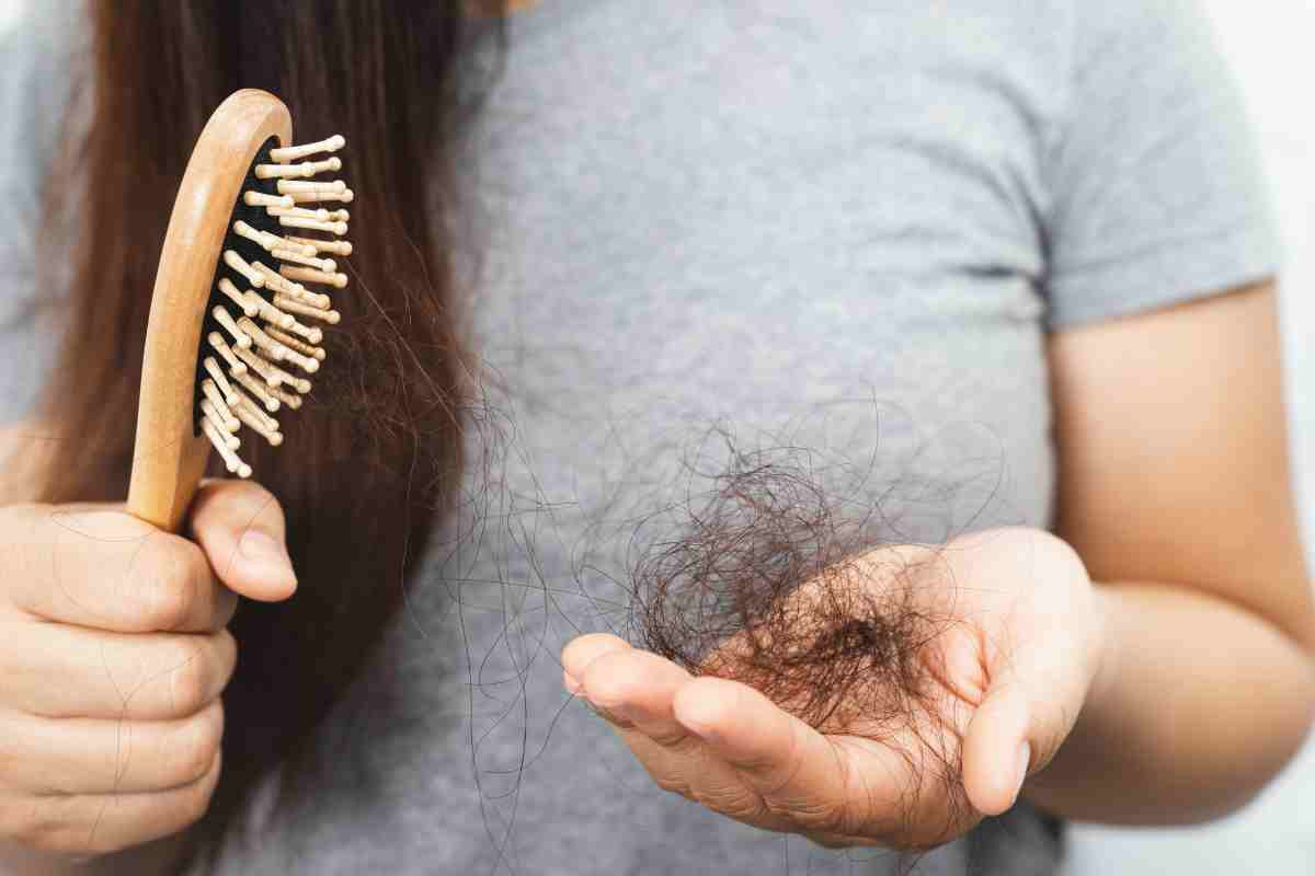 Telogen Effluvium stress shedding hair