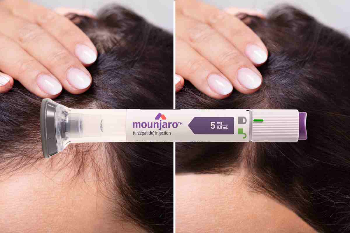 Helpful Mounjaro Hair Loss Info For Anyone Taking GLP1