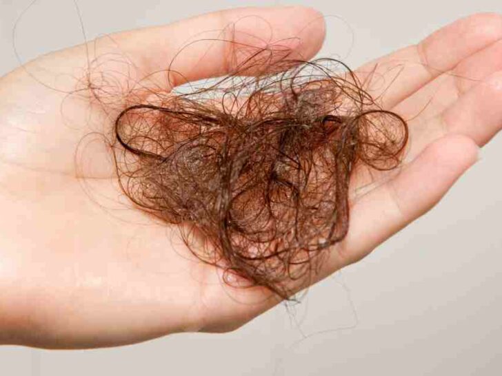 mounjaro hair loss side effect