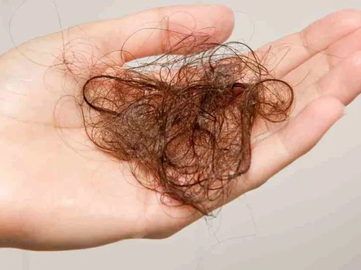 mounjaro hair loss side effect