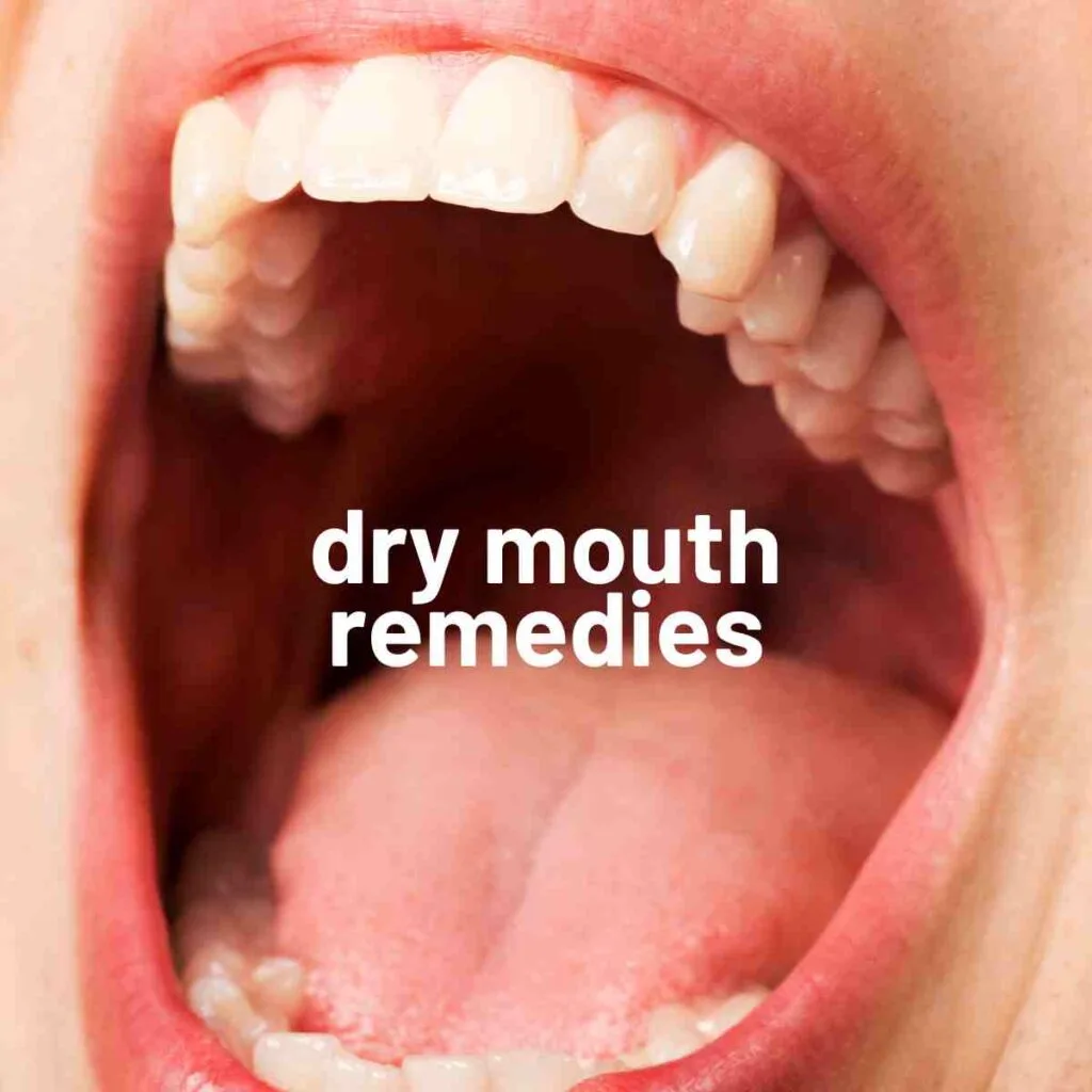 dry mouth remedies photo of mouth open with  cotton mouth