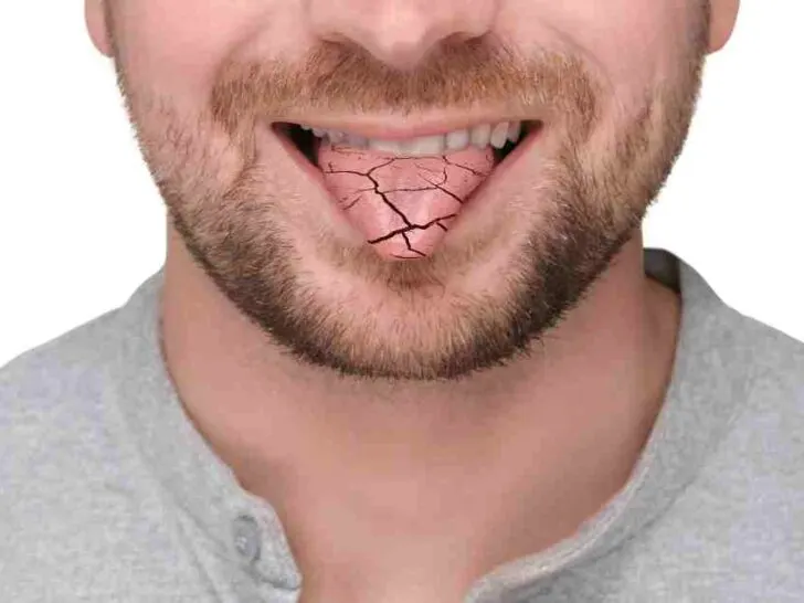 Mounjaro Dry Mouth? Here are 5 Helpful Solutions