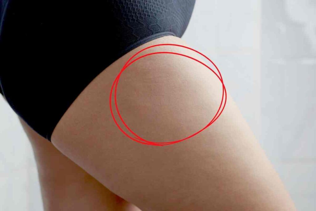 thigh injecting mounjano side effects